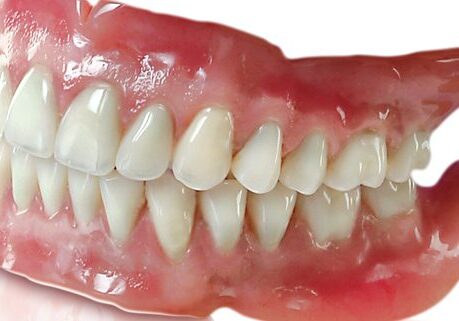 Dentures-2024-641x321